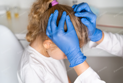Head Lice Treatment in Birmingham AL | How to Get Rid of Lice Fast
